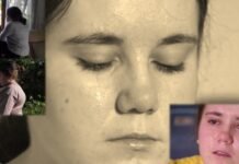 “Kam menduar më mirë të mos jem”, rasti tronditës i Danielës, 16 vjeçe me skoliozë, e bullizuar në shkollë