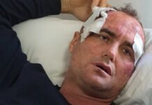 I bëri motrës së tij një koment në Facebook, punonjësi i policisë dhunon rëndë babë e bir. Emrat