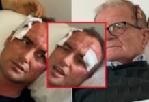 Altin Meçja tregon si u dhunua nga polici pse i bëri kompliment motrës së tij: Gjithçka ishte e organizuar