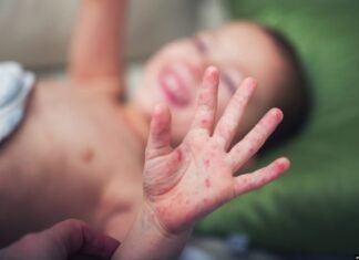 Shpërthen fruthi në SHBA, autoritetet bëjnë thirrje për vaksinim