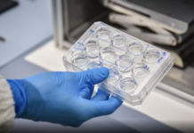 Tragjedi në Itali! 47-vjeçarja shqiptare humb jetën pas diagnozës së gabuar, familja dëmshpërblehet me 300 mijë euro