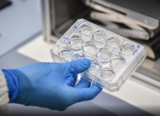 Tragjedi në Itali! 47-vjeçarja shqiptare humb jetën pas diagnozës së gabuar, familja dëmshpërblehet me 300 mijë euro