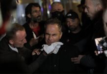 Boçi, Noka, Kalaja, Balliu…. lëndohen gjatë protestës