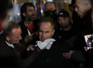 Boçi, Noka, Kalaja, Balliu…. lëndohen gjatë protestës