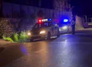 Drejtuesi i motomjetit humb kontrollin dhe përplaset me murin, plagosen ai dhe pasagjerja