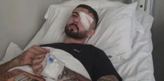“Plumbin e kam ende në sy”/ Flet Erjon Vishkulli që u plagos në protestë: Isha 30 metra larg efektivëve, po rrija pa asnjë reagim