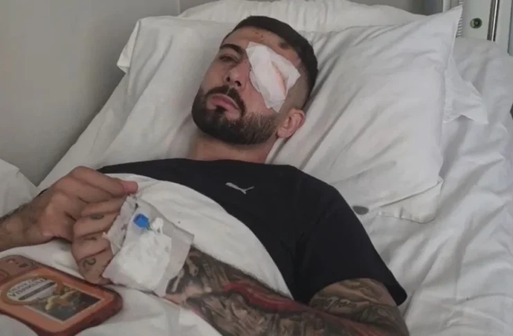 “Plumbin e kam ende në sy”/ Flet Erjon Vishkulli që u plagos në protestë: Isha 30 metra larg efektivëve, po rrija pa asnjë reagim