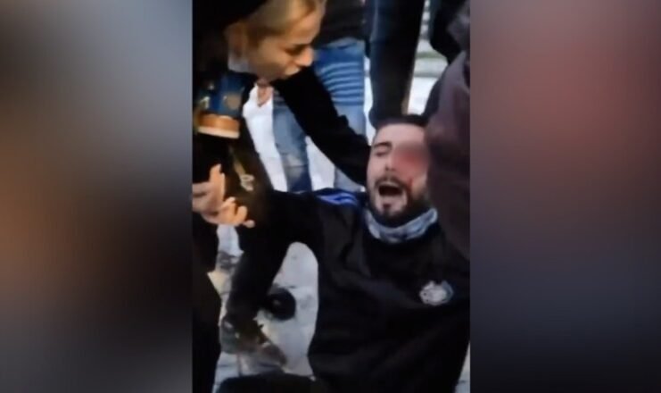 Moment i rëndë nga protesta: I riu goditet në sy me plumb gome